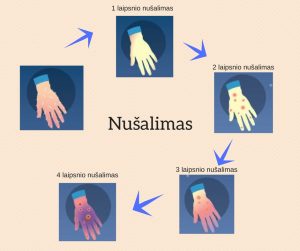 Nu&scaron;alimas 1